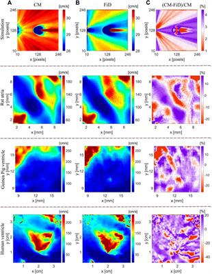 Circle Method for Robust Estimation of Local Conduction Velocity High-Density Maps From Optical Mapping Data: Characterization of Radiofrequency Ablation Sites
